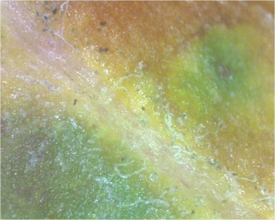 Das ist die Blattader